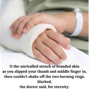 I am very bothered verse 2. Image of a bandaged hand